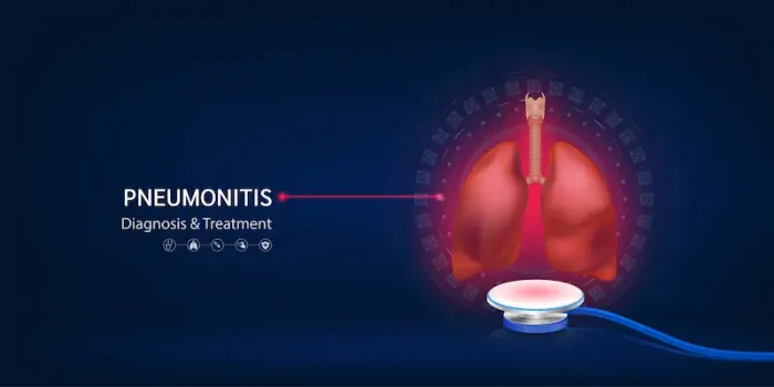 Pneumonitis Overview and Treatment Options